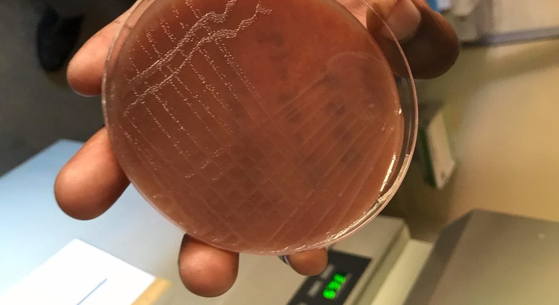 Sub-culture growth of gonorrhea colonies