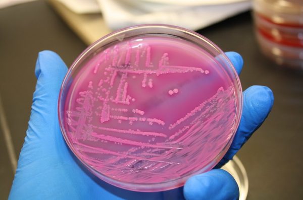 A glass container with bacteria samples, held in the gloved hand of a researcher.